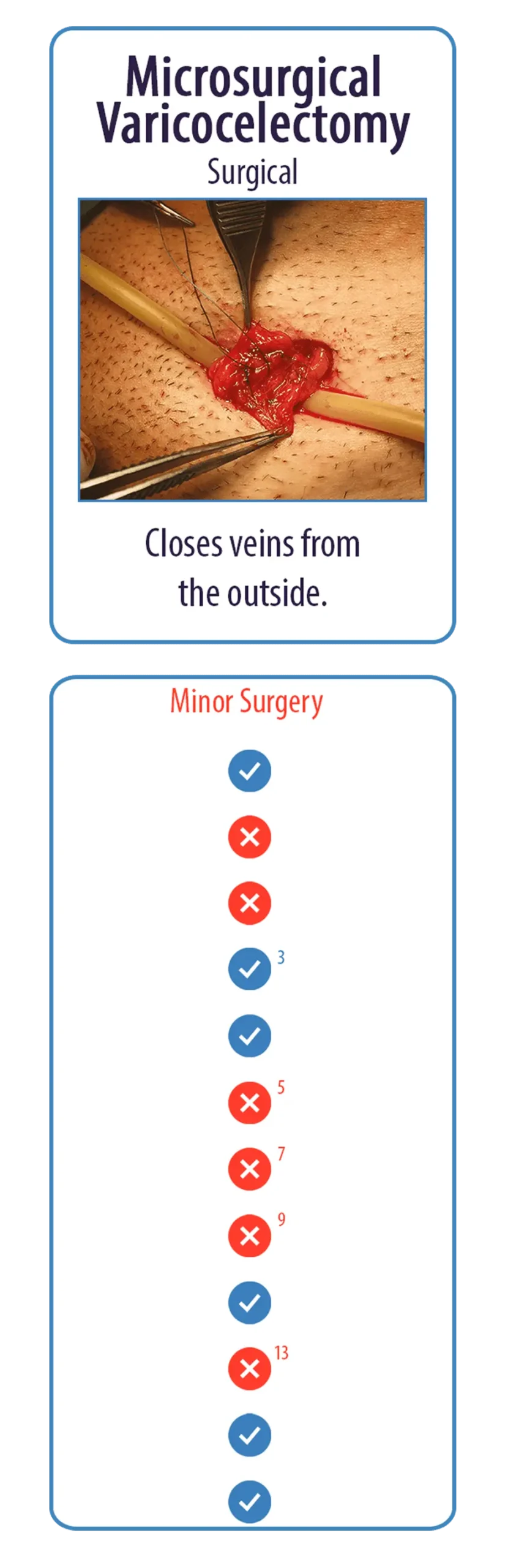 Microsurgical Varicocelectomy