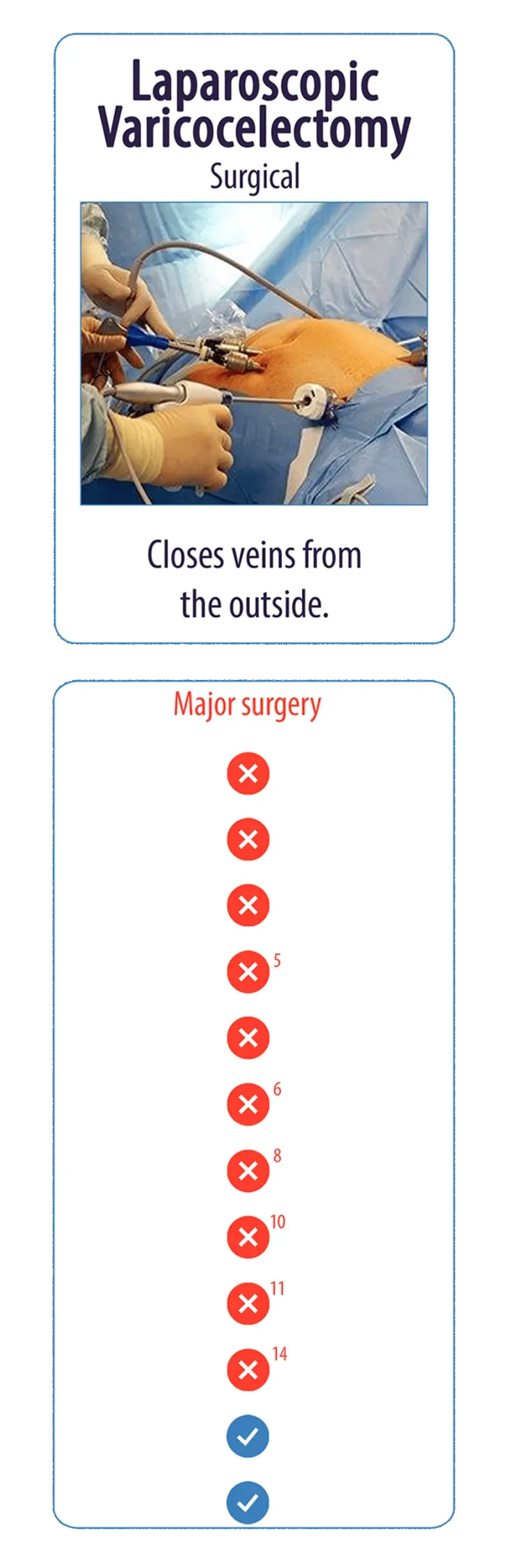 Laproscopic Varicocelectomy